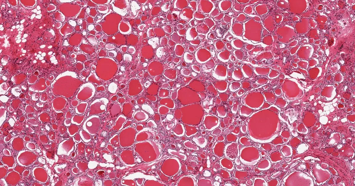 Biologisches Alter: Warum Herz, Lunge und Gehirn unterschiedlich schnell altern